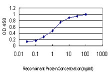 E - S100A6 Antibody (monoclonal) (M10) AT3759a